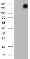 BRCA1 Antibody (aa1151-1473, clone OTI2A5)