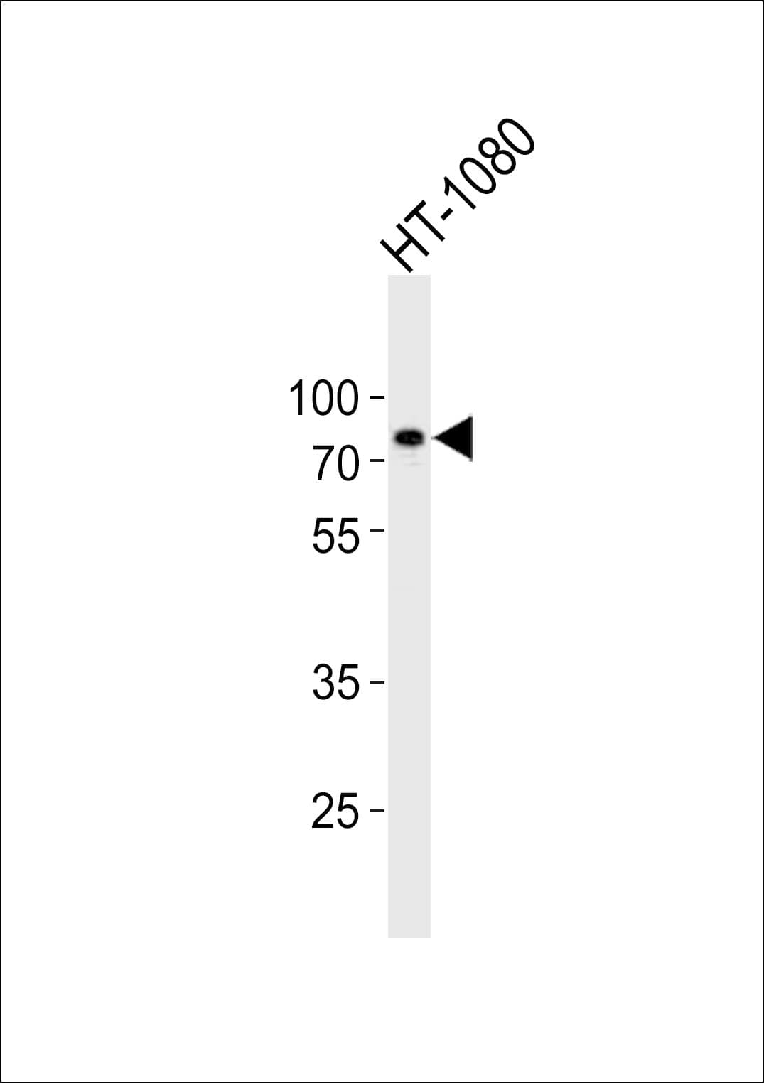 ACAP2 / Centaurin Beta 2 Antibody (aa489-522)