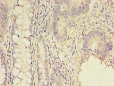 Polyclonal Rabbit anti-Human SCNN1G / ENaC Gamma Antibody (IHC)