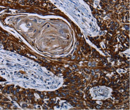 Polyclonal Rabbit anti-Human CPT2 Antibody (IHC, IF, WB)