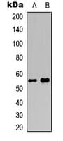 MEF2D Antibody (phospho-Ser444)