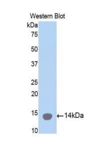COL2A1 / Collagen II Alpha 1 Antibody (aa1226-1331, HRP)