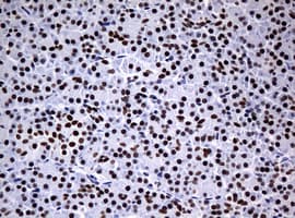 NBN / Nibrin Antibody (aa183-460, clone OTI2F5, Carrier-free)