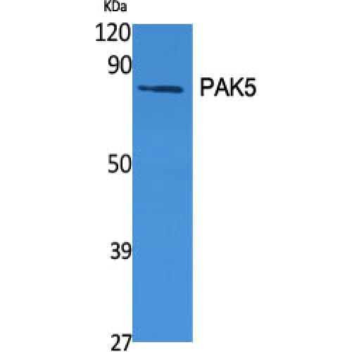 PAK7/PAK5 Antibody (630-710 aa, C-terminal)