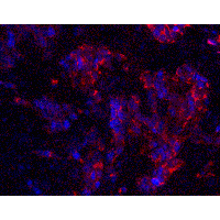 MAGEA4 Antibody
