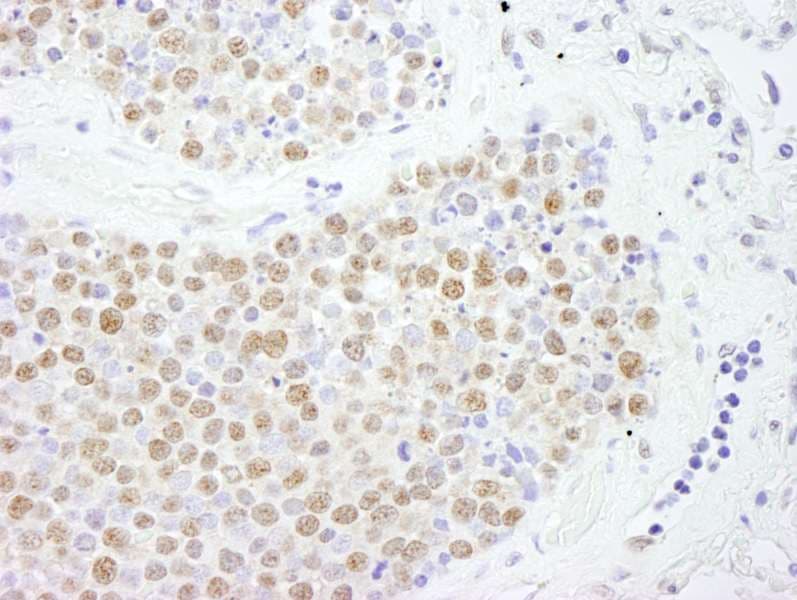 FOXK2 / ILF Antibody (aa635-660)