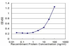 DTNB / Dystrobrevin Beta Antibody (clone 1D3)