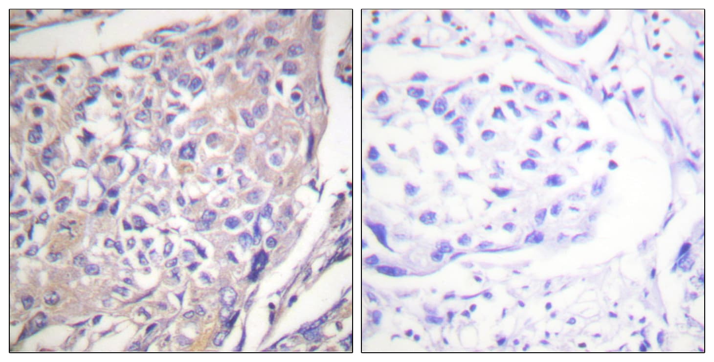 RPS6KB1 / P70S6K / S6K Antibody (phospho-Ser418)