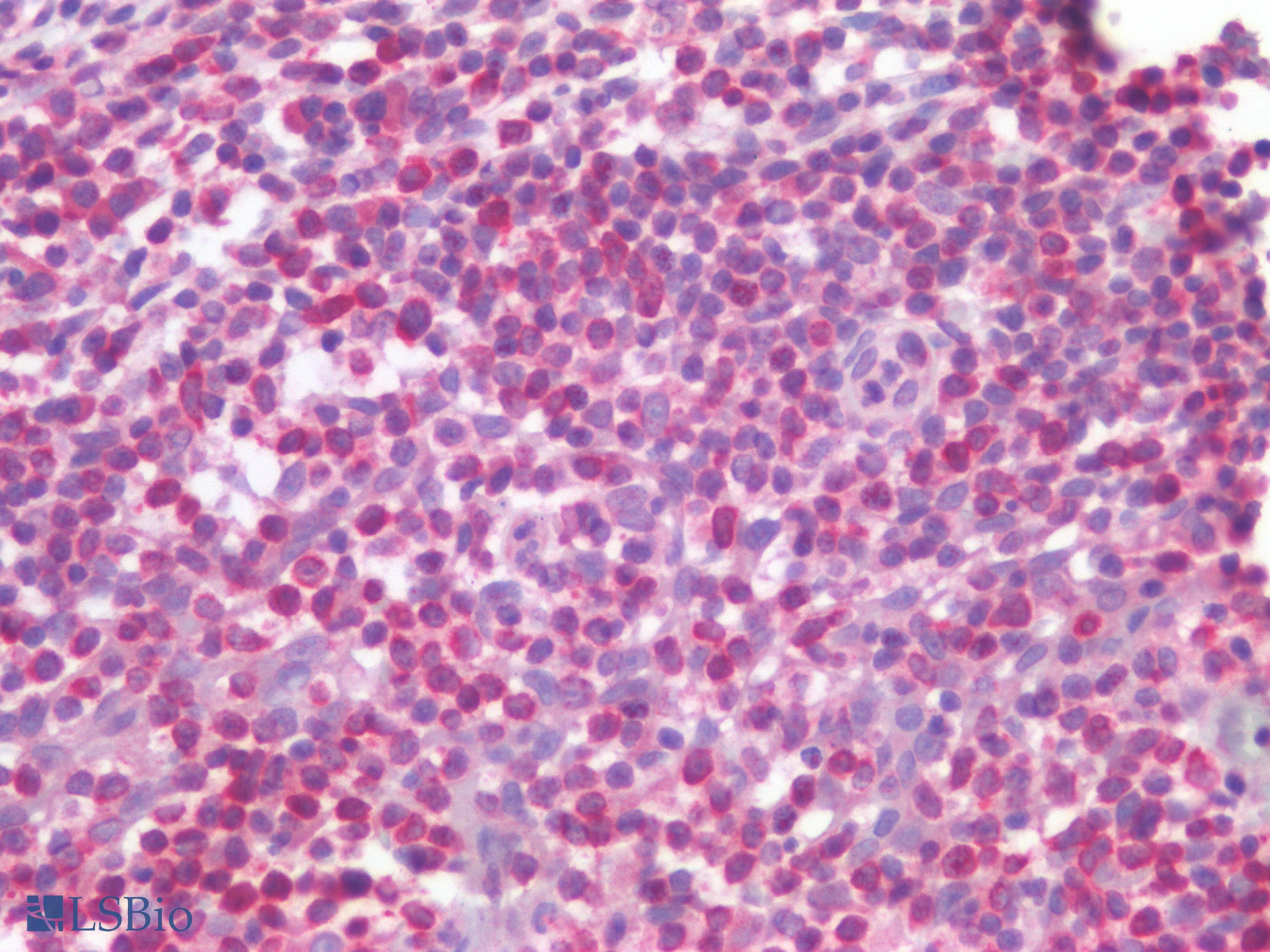 PathPlus™ PTP1B Antibody