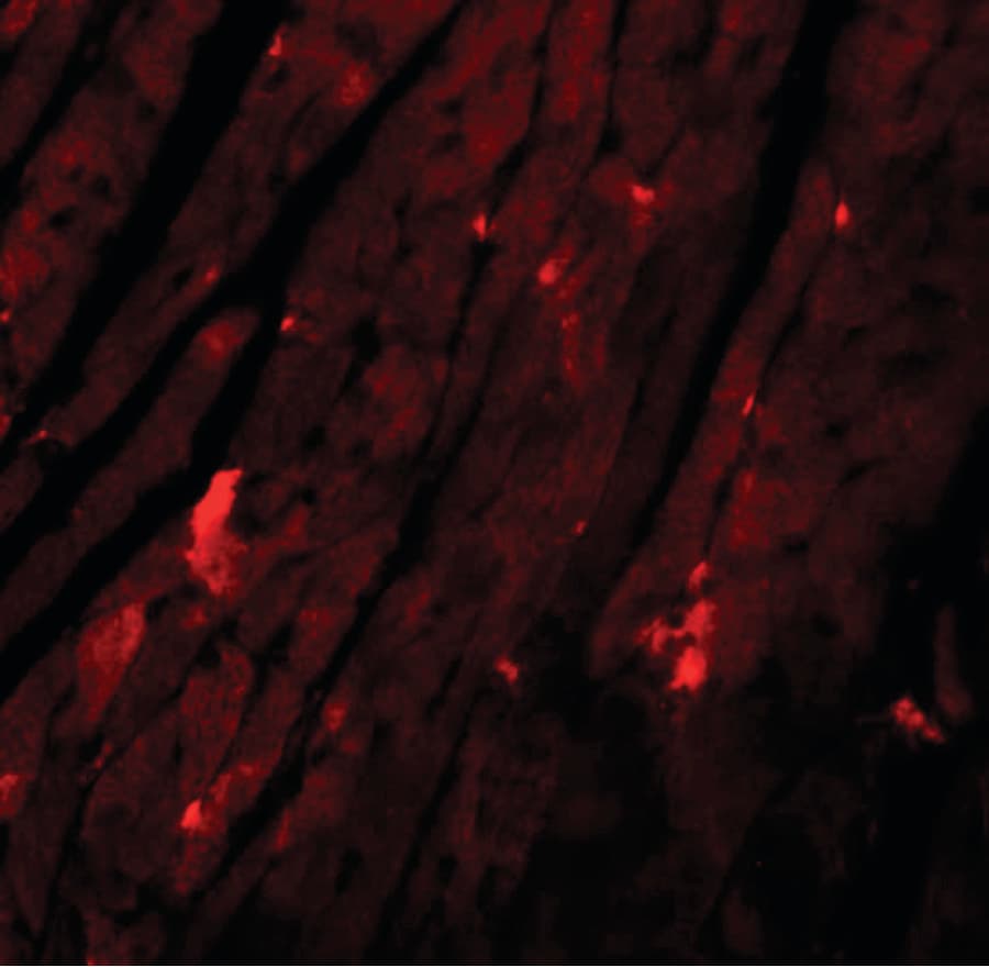 IHC-plus™ Polyclonal Rabbit anti-Human REEP3 Antibody (IHC, IF, WB)