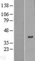 HIBCH Protein (Over-Expression Lysate Myc-DDK (Flag))