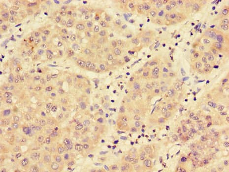 MED17 / TRAP80 Antibody