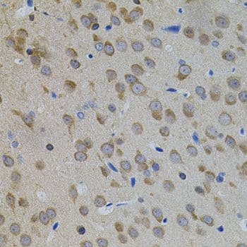 APP / Beta Amyloid Precursor Antibody