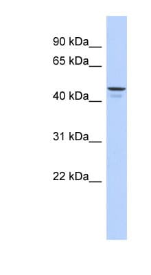 ENPP6 Antibody (aa359-408)
