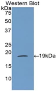IFN Gamma / Interferon Gamma Antibody (aa24-166)