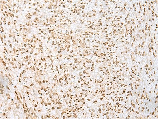 Polyclonal Rabbit anti-Human PNRC2 Antibody (IHC)