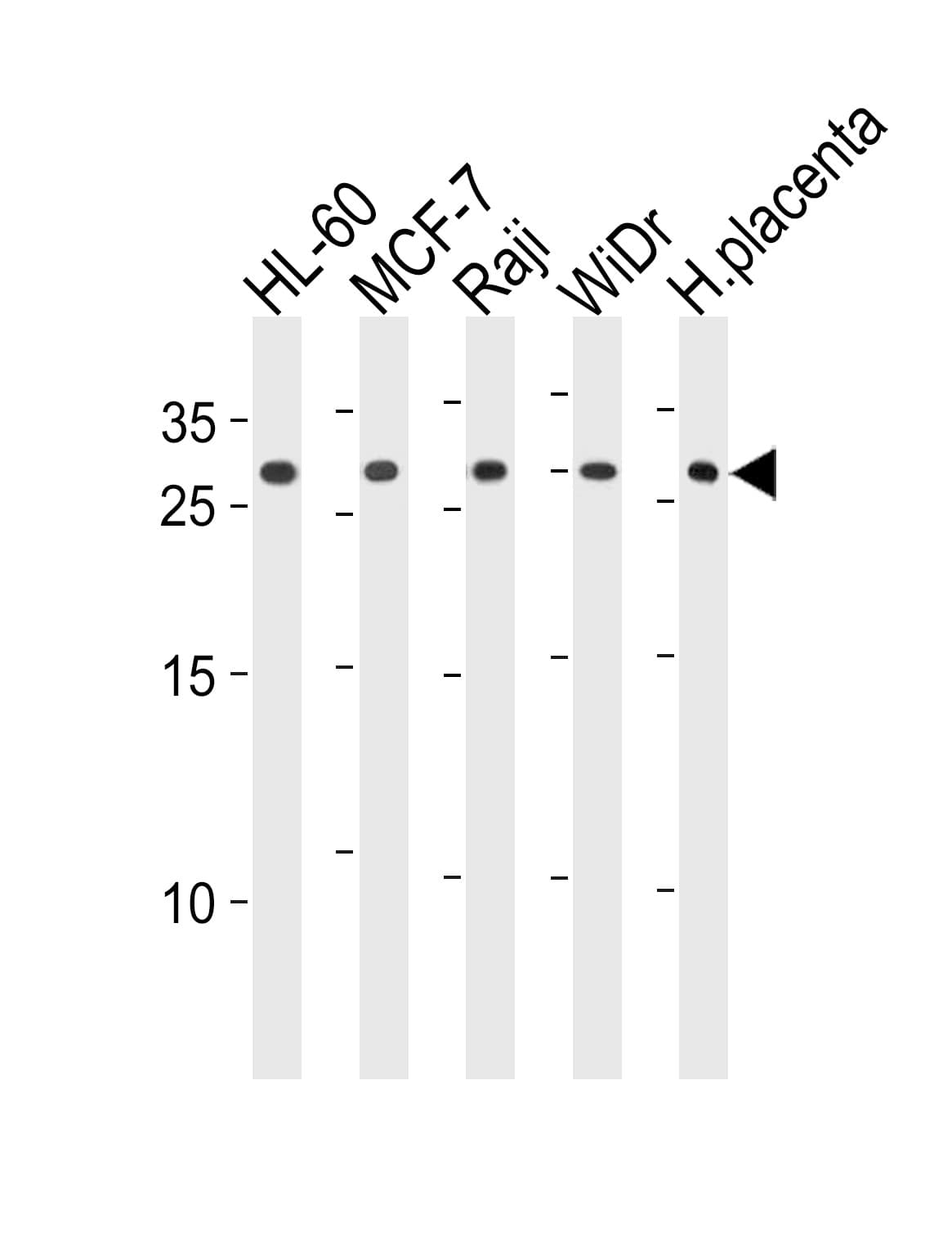 Polyclonal Rabbit anti-Human CLIC1 / NCC27 Antibody (aa136-166, WB)