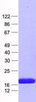 Human BTG2 Protein (Recombinant His, N-Terminal)