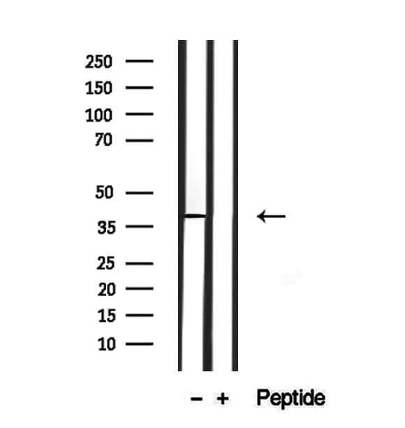 SLC10A2 / ASBT Antibody