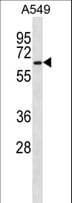 PRPF31 Antibody (aa334-361)