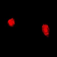 Polyclonal Rabbit anti-Human TPP2 Antibody (IHC, IF, WB)