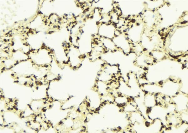 NAMPT / Visfatin Antibody
