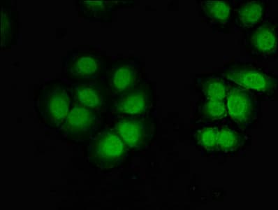 CELF2 / CUGBP2 Antibody