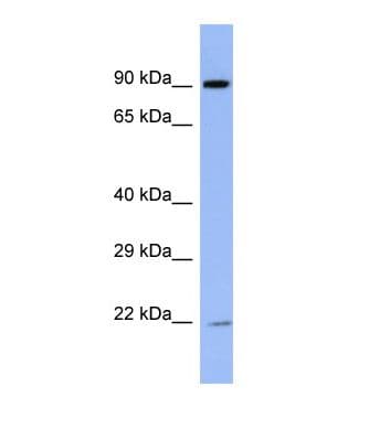 Polyclonal Rabbit anti-Human ZNF780B Antibody (N-Terminus, WB)