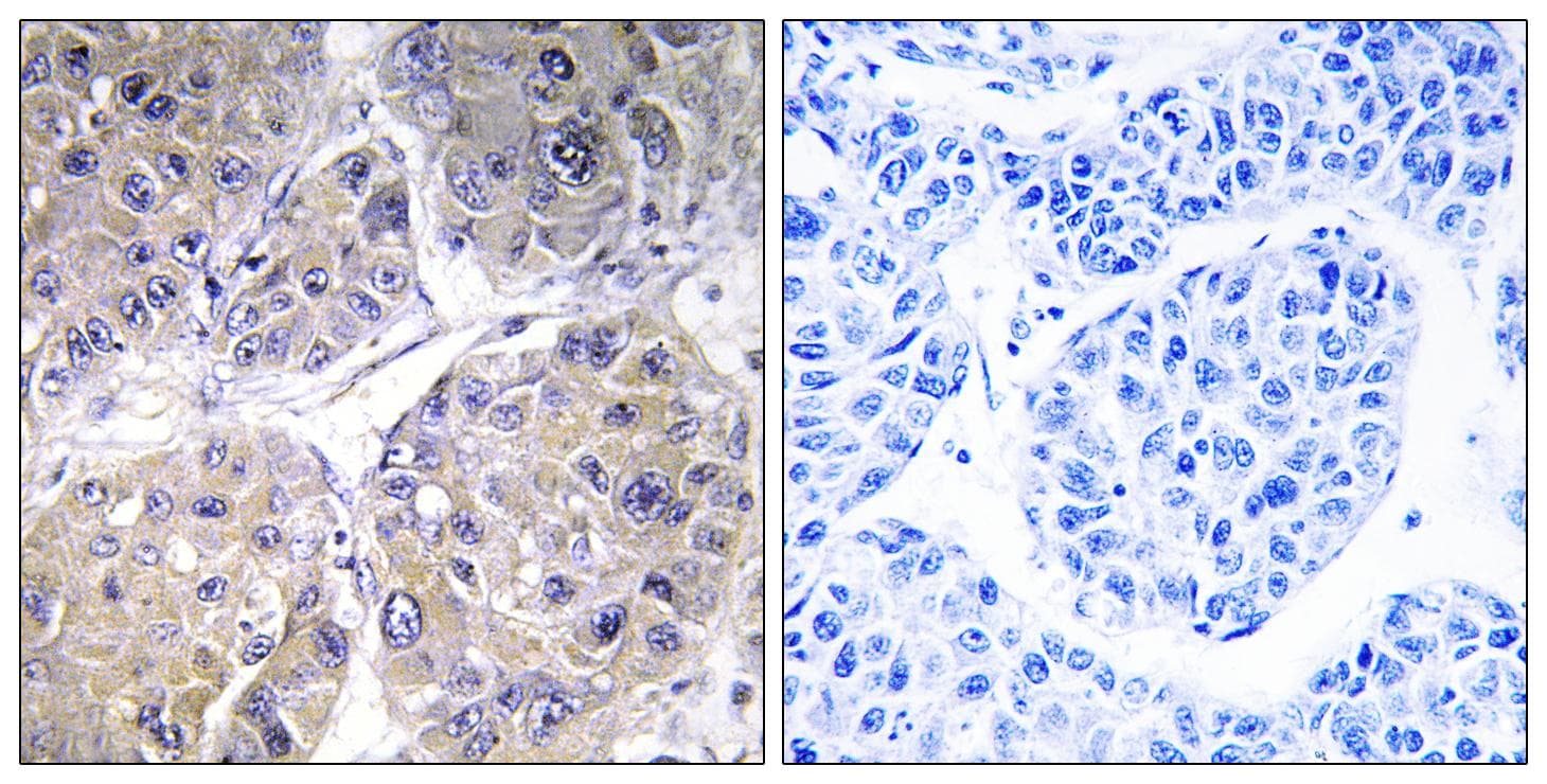 SLC27A5 / BACS Antibody