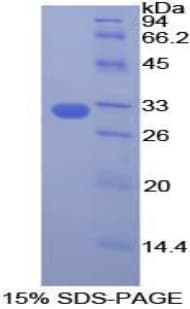 Human DOCK180 / DOCK1 Protein (Recombinant His-T7)