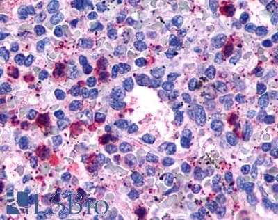 PathPlus™ Polyclonal Rabbit anti-Human GPR146 Antibody (Cytoplasmic Domain, IHC)