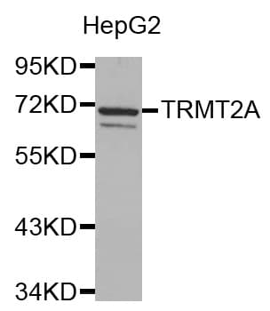 TRMT2A Antibody