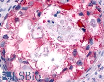 PathPlus™ PGR1 / GPR153 Antibody (Extracellular Domain)