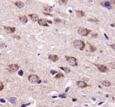 USP9X / FAM Antibody