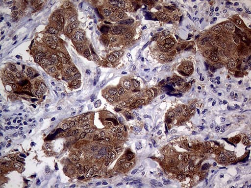 Monoclonal Mouse anti-Human p16INK4a / CDKN2A Antibody (clone OTI4H4, IHC, WB)
