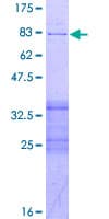 Human PPP2R2B Protein (Recombinant GST)