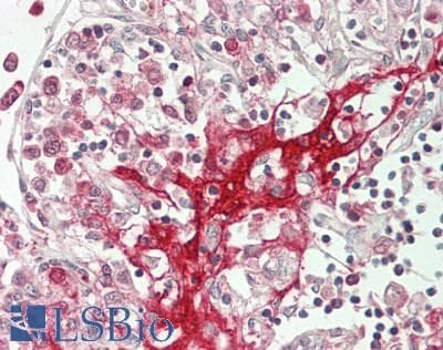 IHC-plus™ ADCK3 / CABC1 Antibody (Internal)