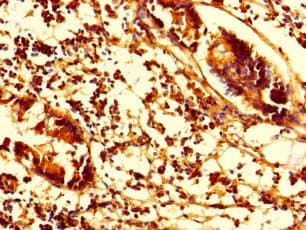 SMAP1 Antibody