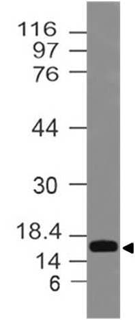 Polyclonal Rabbit anti-Human MAP1LC3A / LC3A Antibody (WB)
