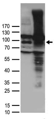 Polyclonal Rabbit anti-Human VR1 / TRPV1 Antibody (WB)