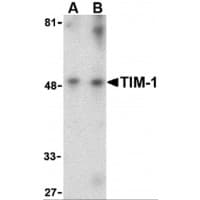 PathPlus™ Polyclonal Rabbit anti-Human HAVCR1 / KIM-1 Antibody (IHC, WB)