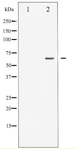 ER Alpha / Estrogen Receptor Antibody (phospho-Ser167)