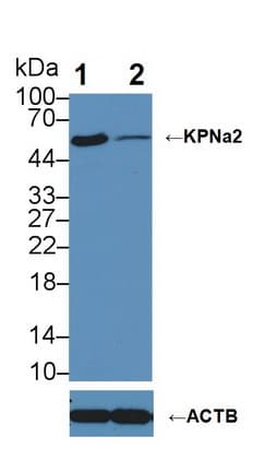 KPNA2 / Importin Alpha 1 Antibody (aa157-412)