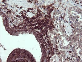 CD45 / LCA Antibody (clone OTI1F6)