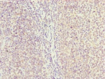 HAUS8 Antibody
