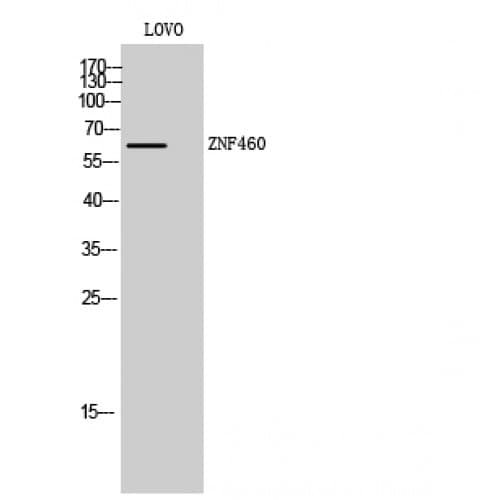 ZNF460 Antibody (430-510 aa, C-terminal)