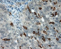 LIPG / Endothelial Lipase Antibody (clone OTI2E12, Carrier-free)