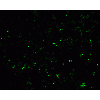 VCL / Vinculin Antibody