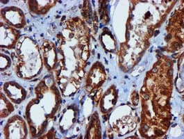 CYB5R3 / B5R Antibody (clone OTI1E8)