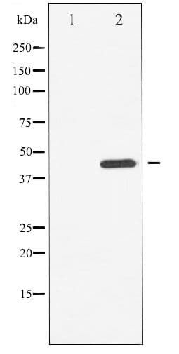 Polyclonal Rabbit anti-Human CHEK1 / CHK1 Antibody (phospho-Ser296, IHC, WB)